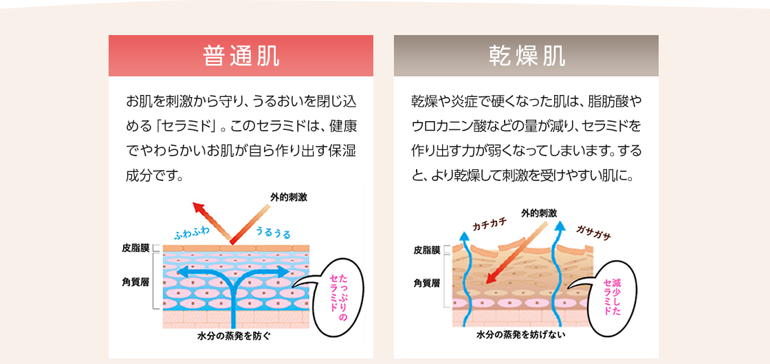 普通肌乾燥肌