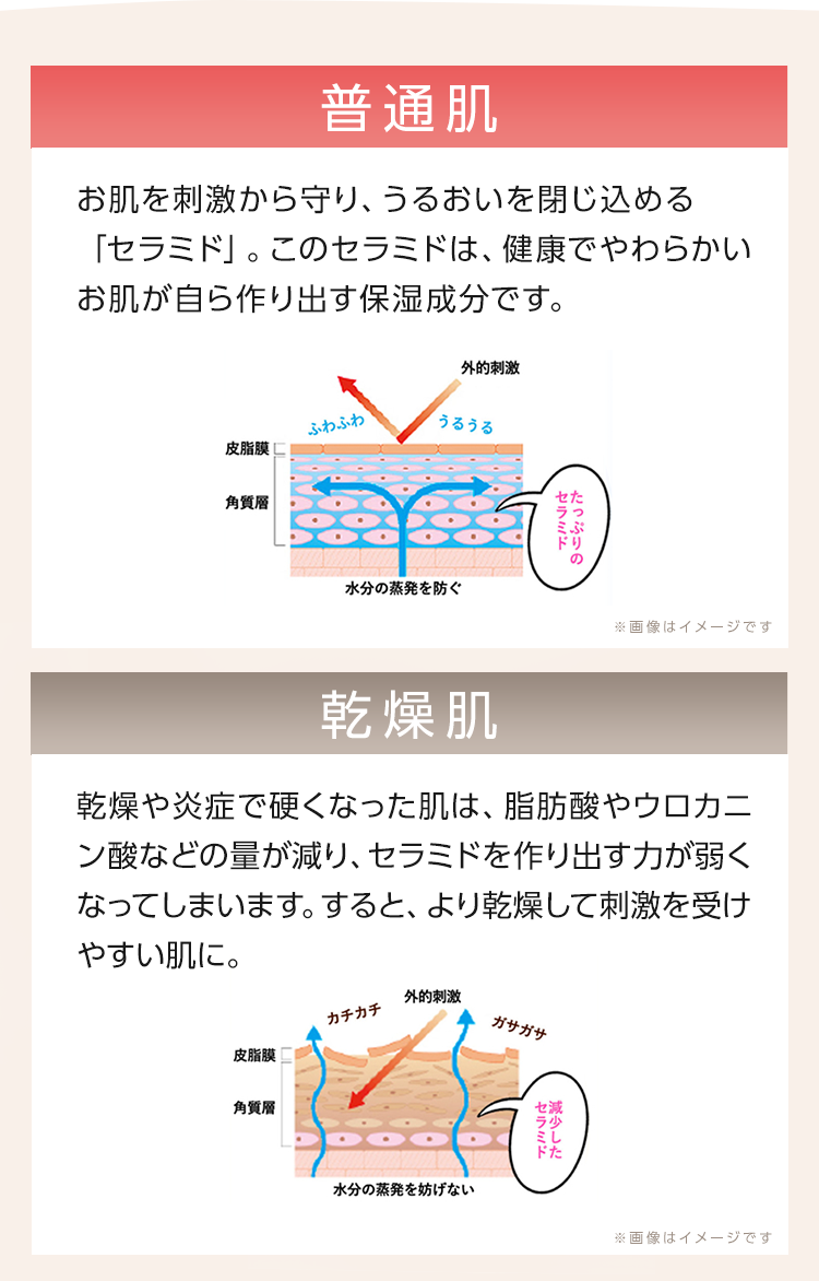 普通肌乾燥肌